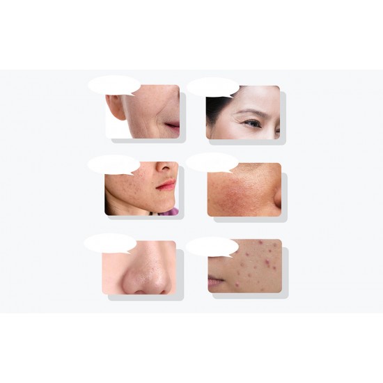 Ultrasonic facial massager with light therapy ANLAN 01-ADRY15-001